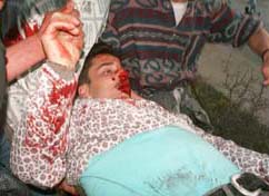 Photo: Abdullah being taken down from the mountain.