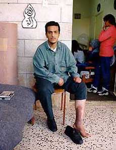 Photo: Ghassan's brother Suffiyan, displaying the marks of torture